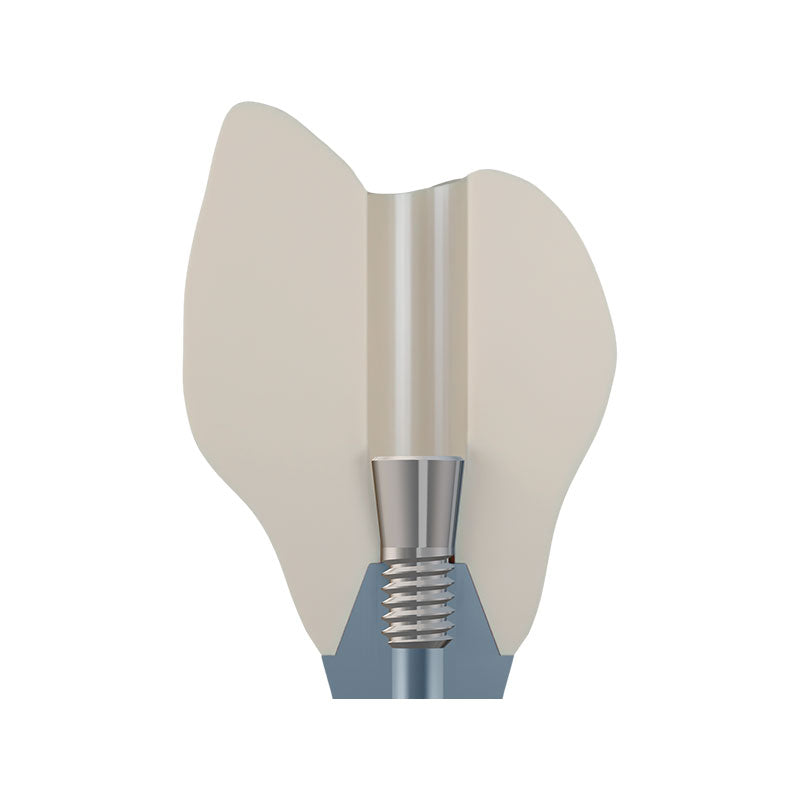 DSI EvoConnect M1.7 - Direct Сonnection Screws for Multi-Unit Abutments