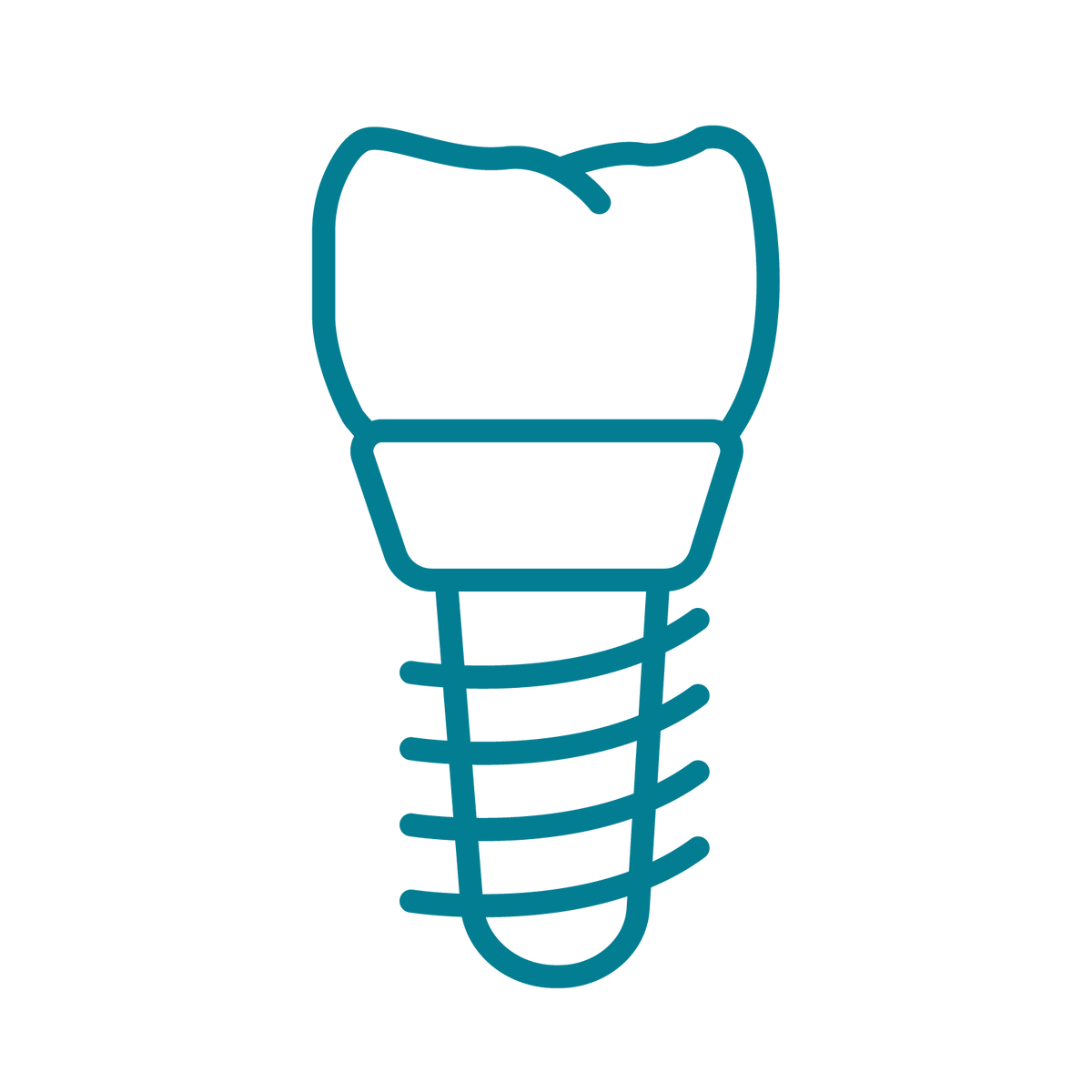 Implantológia