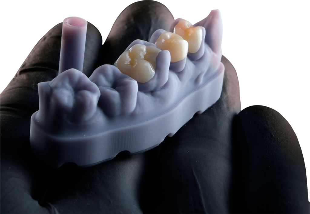 FGM VoxelPrint Ceramic 3D nyomtatási resin – végleges fogpótlásokhoz (250 g)