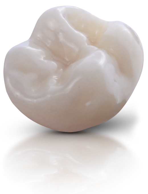 FGM VoxelPrint Ceramic 3D nyomtatási resin – végleges fogpótlásokhoz (250 g)