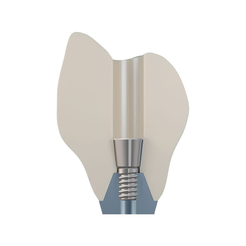 DSI EvoConnect M1.6 - Direct Сonnection Screws for Multi-Unit Abutments